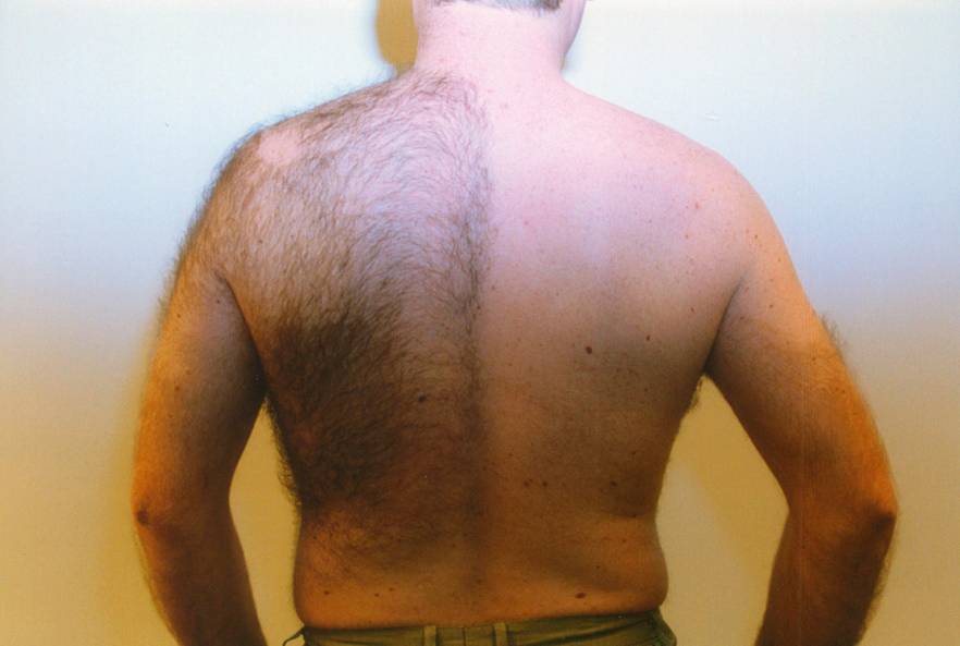 Men's back hair clearance removal